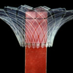 Column experimentation